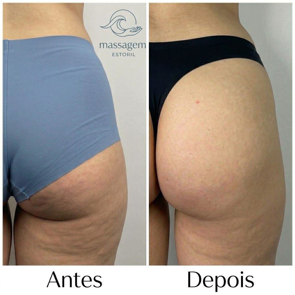 Antes e depois